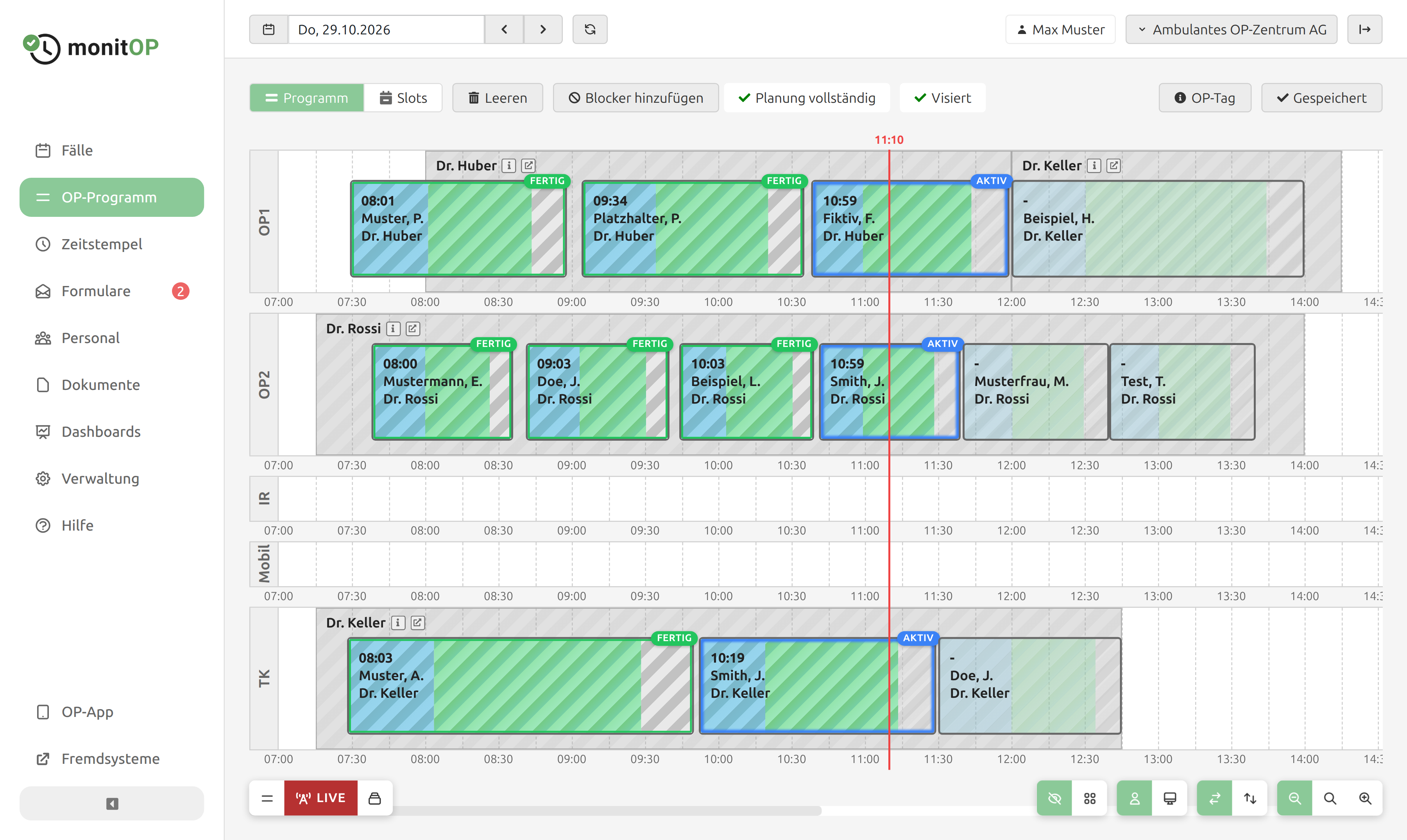 MonitOP operating room program showing procedure schedules, rooms and status updates